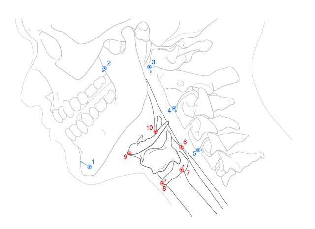 Anatomical landmarks of swallow