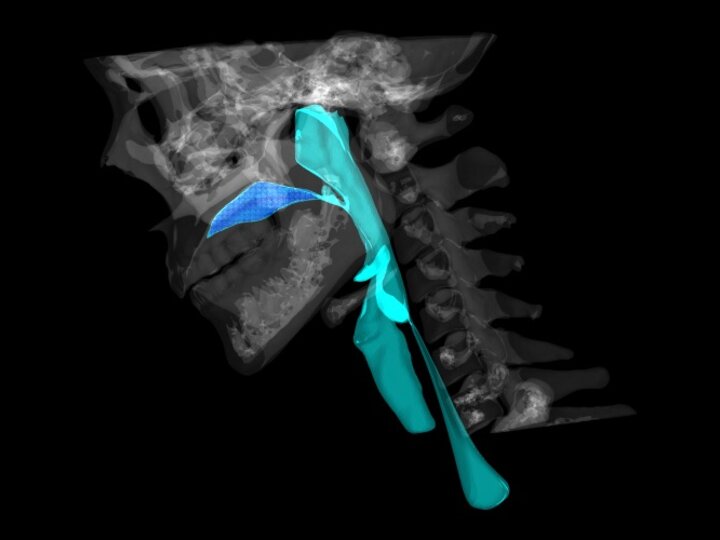 x-ray image with colored overlay